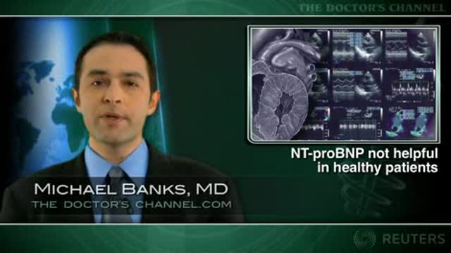 Don’t bother with NT-proBNP tests in healthy normal patients: study Thumbnail