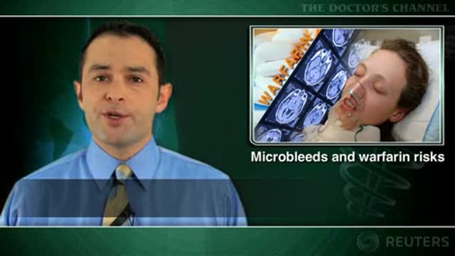 Microbleeds increase cerebral hemorrhage risk in warfarin users Thumbnail