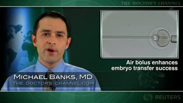 Modified embryo transfer technique boosts pregnancy rates Thumbnail