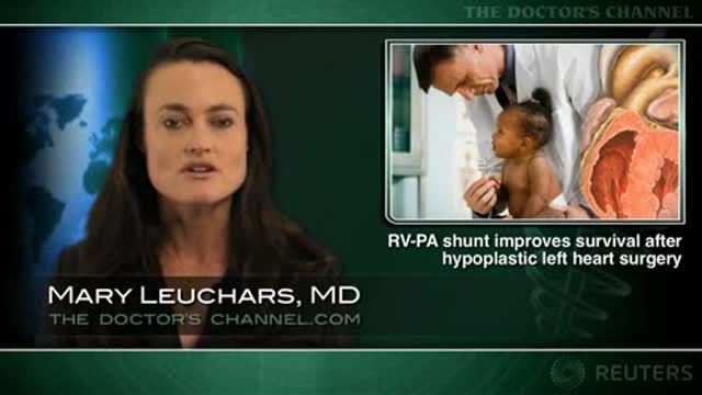 RV-PA shunt improves survival after hypoplastic left heart surgery Thumbnail