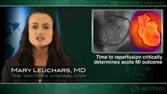 Time to reperfusion a critical determinant of acute MI outcome: study Thumbnail