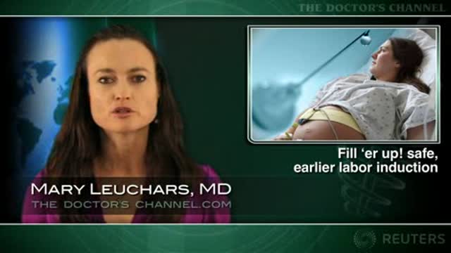 Labor induction more effective with Foley balloon inflated to 60-mL Thumbnail