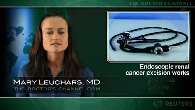 Endoscopic approach spares kidney in low grade cancer Thumbnail