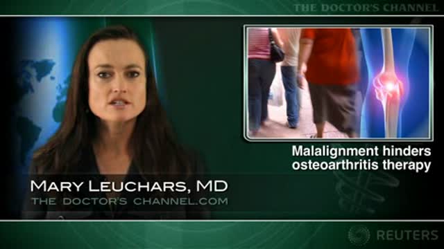 Doxycycline’s anti-osteoarthritis effect reduced in bowlegged women Thumbnail