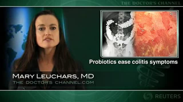 High-potency probiotic mix has benefits in relapsing ulcerative colitis Thumbnail