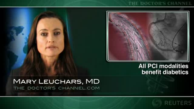 At 1 yr, drug-eluting stents reduce revascularization in diabetics: study Thumbnail