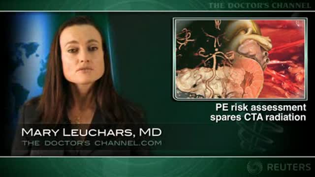 PE risk factor assessment reduces need for CT angiograms Thumbnail