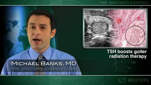TSH-stimulated goiter therapy cuts radiation exposure Thumbnail