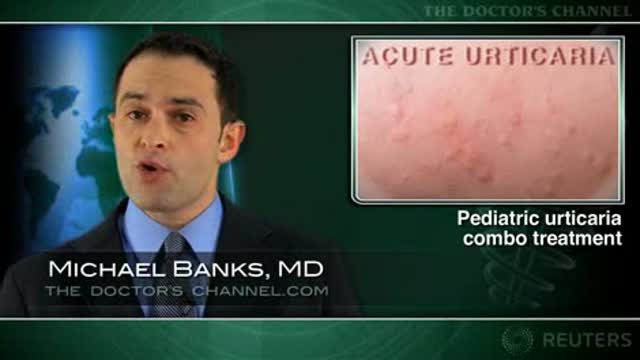 Oral plus IV treatment seen more effective for pediatric urticaria Thumbnail
