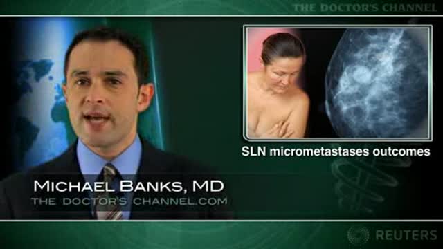 Sentinel node micrometastases do not mandate complete axillary node dissection Thumbnail