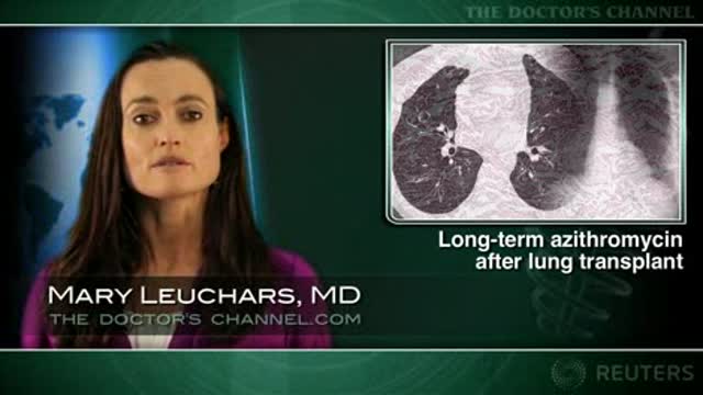 Prophylactic azithromycin reduces bronchiolitis obliterans rates in lung transplantees Thumbnail