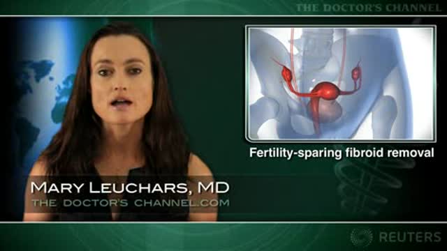 Uterine artery occlusion during laparoscopic myomectomy reduces blood loss Thumbnail