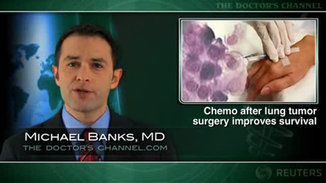 Adoption of adjuvant chemo for early lung cancer has improved outcomes Thumbnail