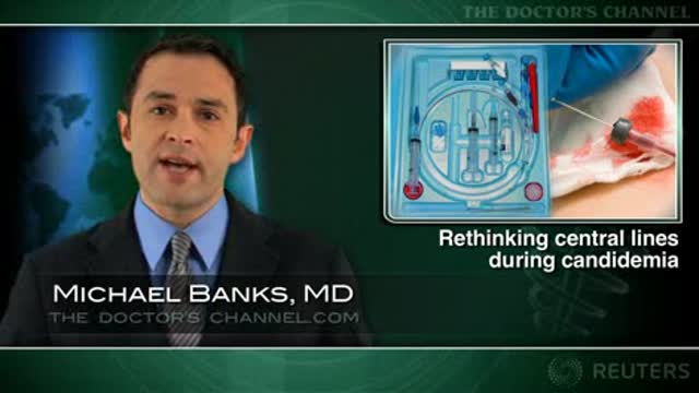 Candidemia standard-of-care questioned Thumbnail
