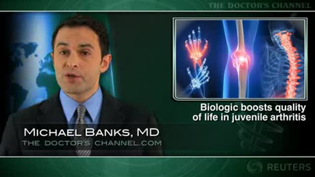 Abatacept improves quality of life of children with juvenile arthritis Thumbnail