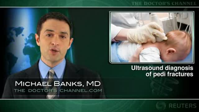 ER diagnosis of pediatric clavicle fracture accurate with ultrasound Thumbnail