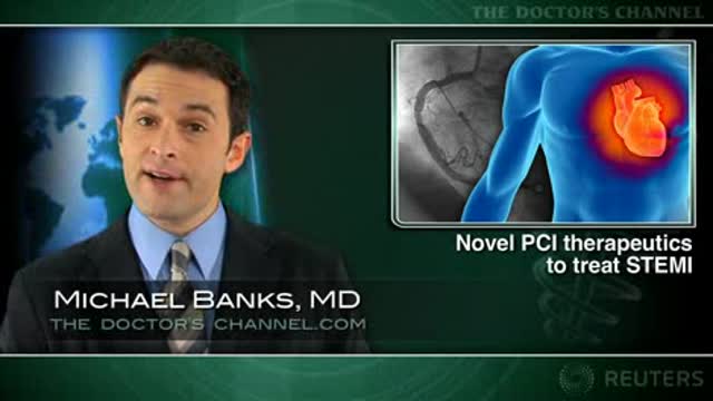 Cheaper alternatives to abciximab seen effective in primary PCI for MI Thumbnail
