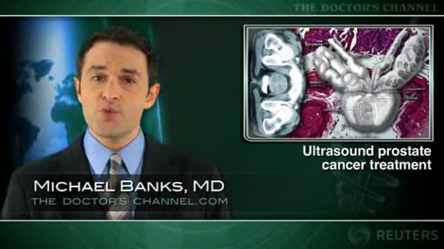 High intensity focused ultrasound effective for localized prostate cancer Thumbnail