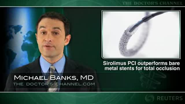 Sirolimus-eluting stents beat bare metal stents for total coronary occlusion Thumbnail