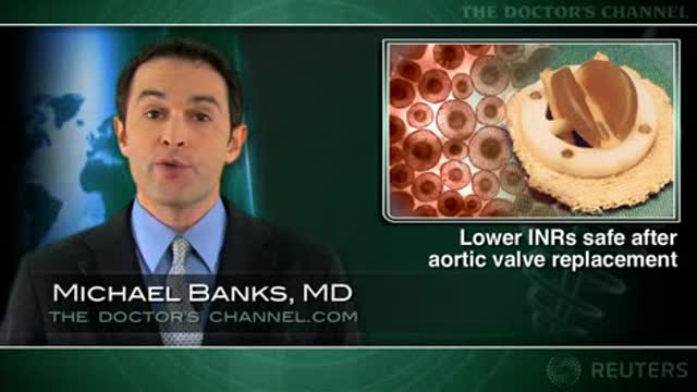 Reduced anticoagulation seen safe for aortic valve replacement patients Thumbnail