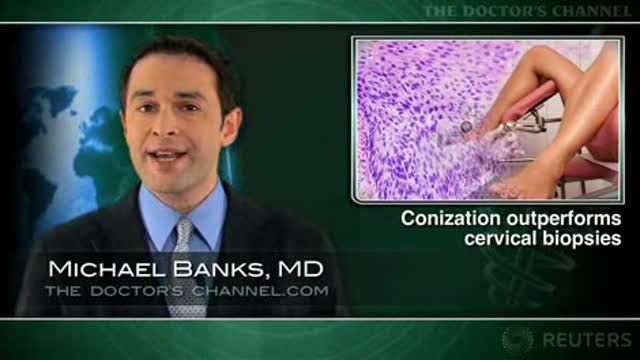 Cervical biopsies not reliable in ruling out high-grade CIN Thumbnail