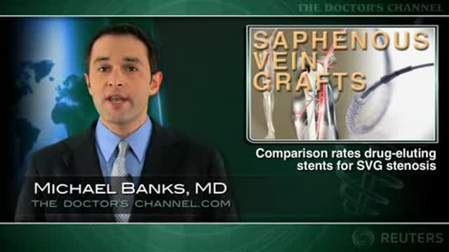Comparison Rates Drug-Eluting Stents for SVG Stenosis Thumbnail