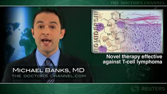 Novel Therapy Effective Against T-Cell Lymphoma Thumbnail