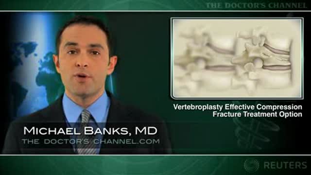 Vertebroplasty Effective Compression Fracture Treatment Option Thumbnail