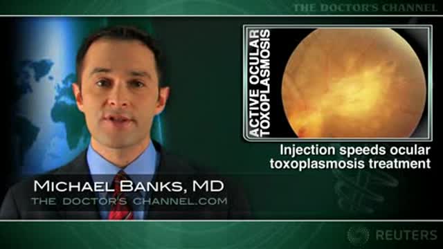 Injection Speeds Ocular Toxoplasmosis Treatment Thumbnail