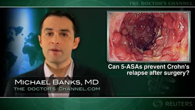 Can 5-ASAs Prevent Crohn’s Relapse After Surgery? Thumbnail