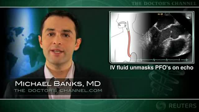 IV Fluid Unmasks PFOs on Echo Thumbnail