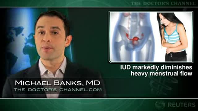 IUD Markedly Diminishes Heavy Menstrual Flow Thumbnail