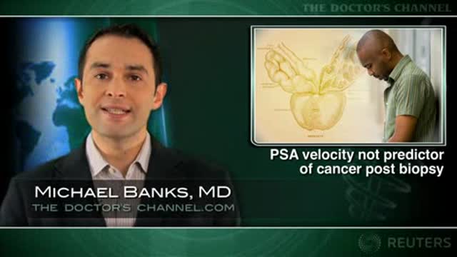 PSA Velocity Not Predictor of Cancer Post Biopsy Thumbnail
