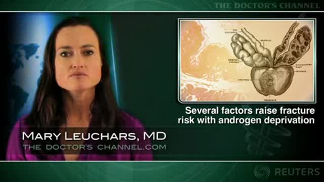 Risk Factors for Fractures During ADT Thumbnail