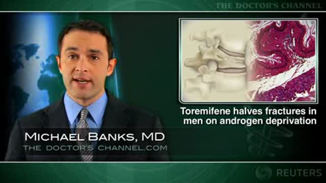 Toremifene and ADT-Related Fractures Thumbnail