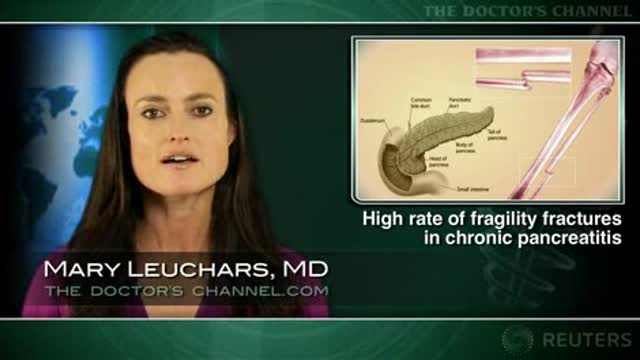 Chronic Pancreatitis and Fractures Thumbnail