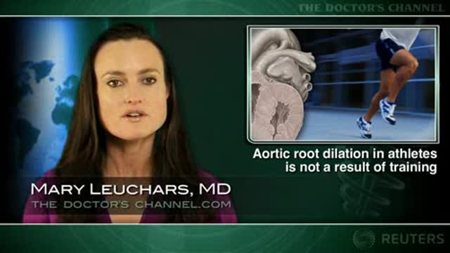 Dilated Aorta in Athletes Thumbnail