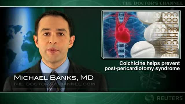 Colchicine for PPS Thumbnail