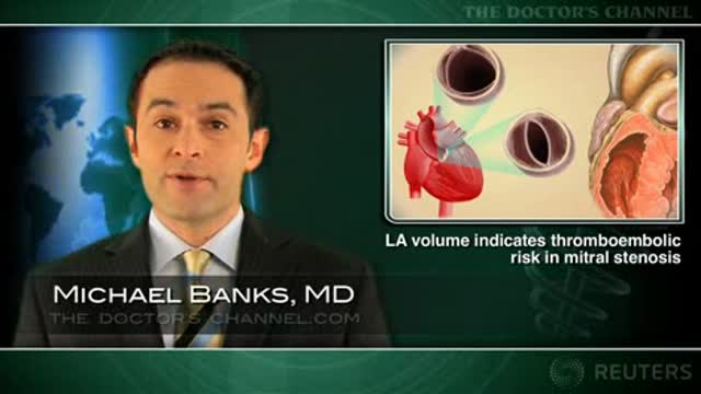 Left atrial volume indicates thromboembolic risk in mitral stenosis Thumbnail