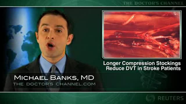 Thigh-length compression stockings reduce DVT rates in immobilized patients Thumbnail