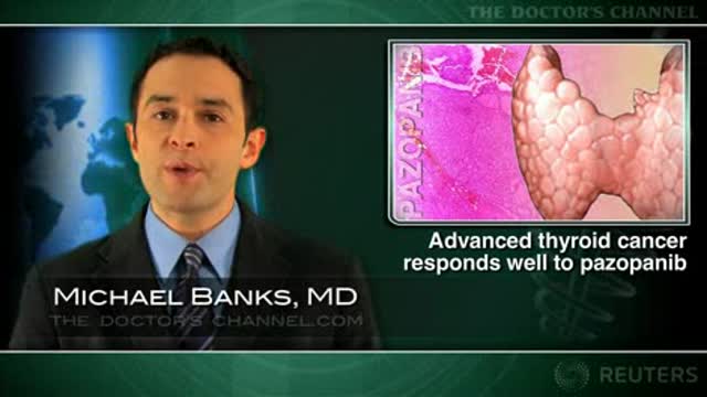 Advanced thyroid cancer responds well to angiogenesis inhibitor pazopanib Thumbnail