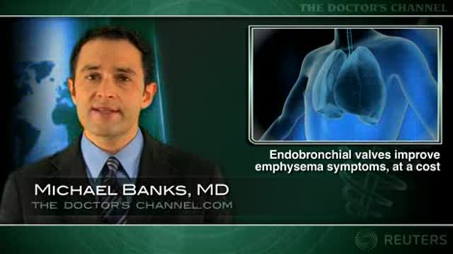 Endobronchial valves improve emphysema symptoms, at a cost Thumbnail