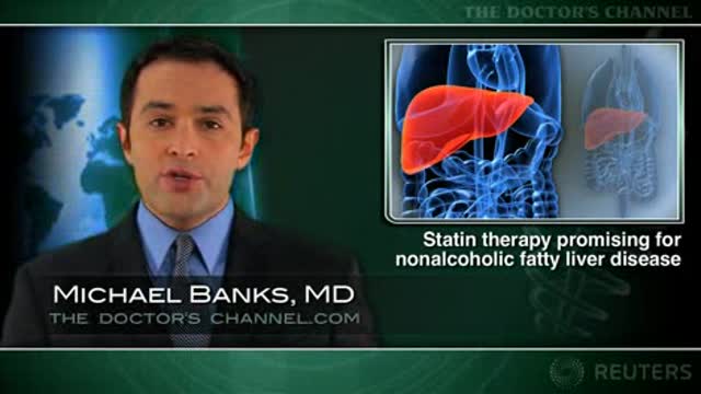 Statin therapy promising for nonalcoholic fatty liver disease Thumbnail