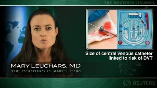 Increasing size of central venous catheter linked to greater risk of DVT Thumbnail