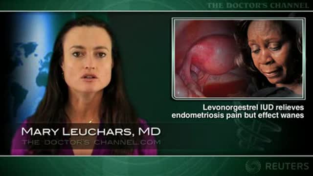 Levonorgestrel IUD relieves postop endometriosis pain but benefits wane Thumbnail