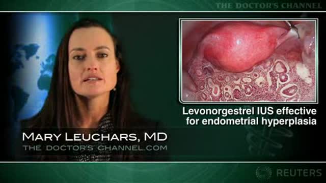Levonorgestrel IUD may be better than oral progestogens for endometrial hyperplasia Thumbnail