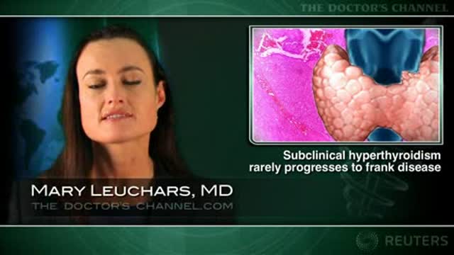 Subclinical hyperthyroidism rarely progresses to frank hyperthyroidism Thumbnail