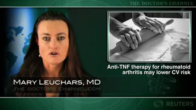 Anti-TNF therapy for rheumatoid arthritis linked to reduced cardiovascular risk Thumbnail