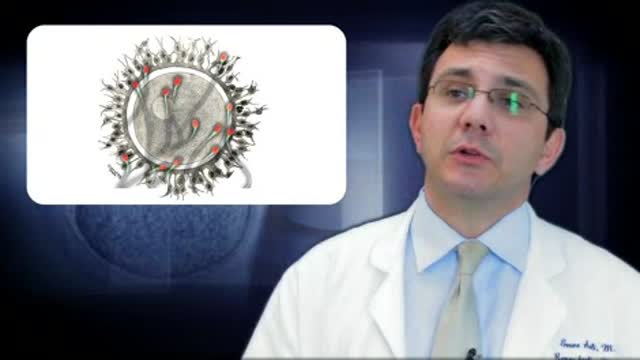 Fertility Preservation for Women – Part 2 Thumbnail