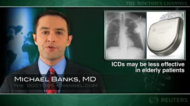ICDs may be less effective in reducing mortality in elderly patients Thumbnail